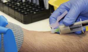 prelievo sangue