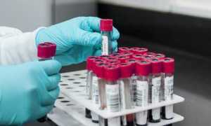 provette sangue