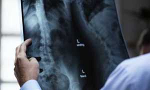 radiografia foto