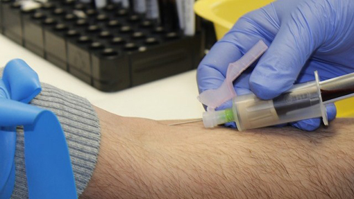 prelievo sangue